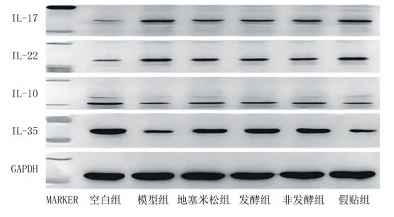 空白组和支气管哮喘各组大鼠肺组织中IL－17、IL－22、IL－10、IL－35蛋白表达电泳图